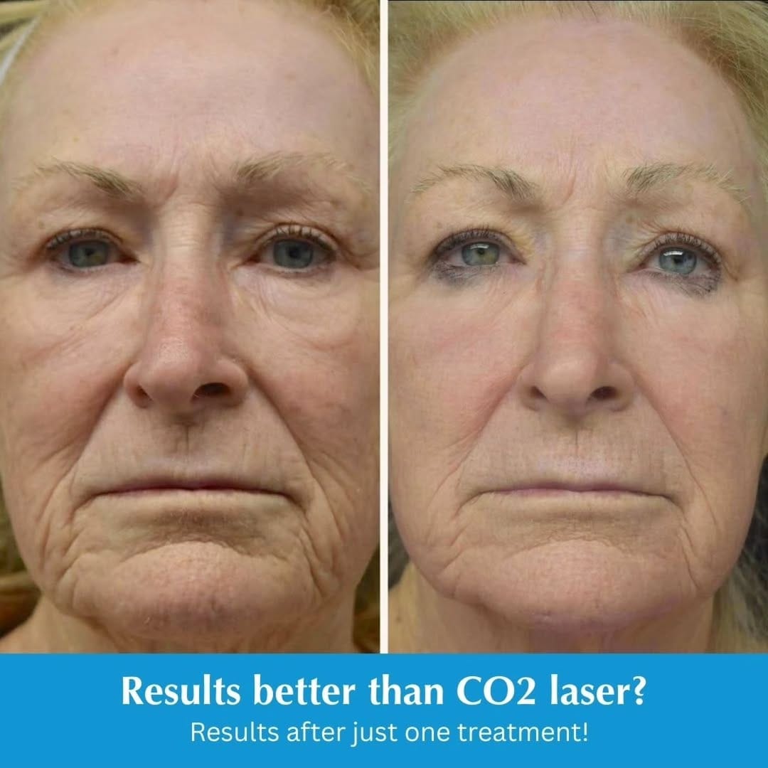 Post 10 by South Coast MedSpa on Instagram (carousel)