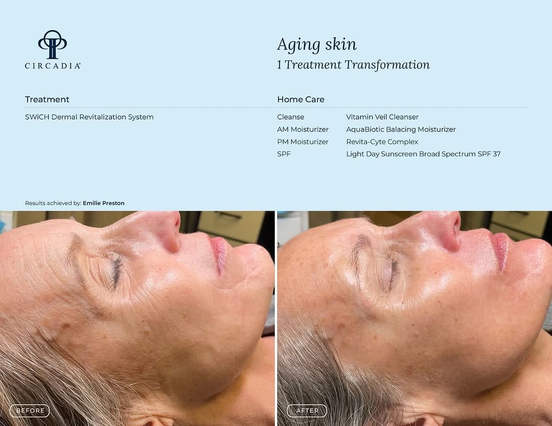 Post 1 by Flawless Skin Studio on Instagram (image)