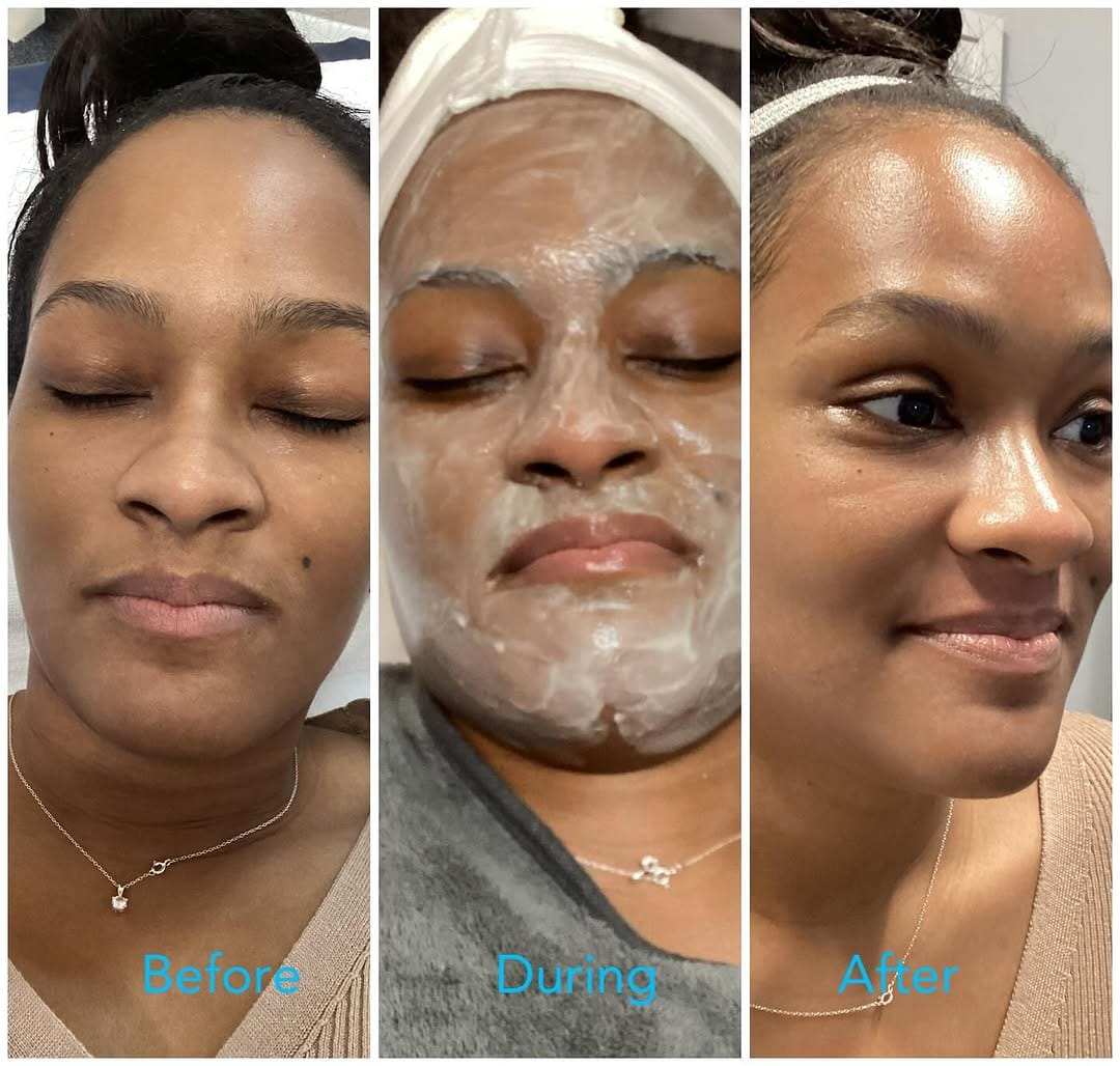 Post 6 by Flawless Skin Studio on Instagram (image)