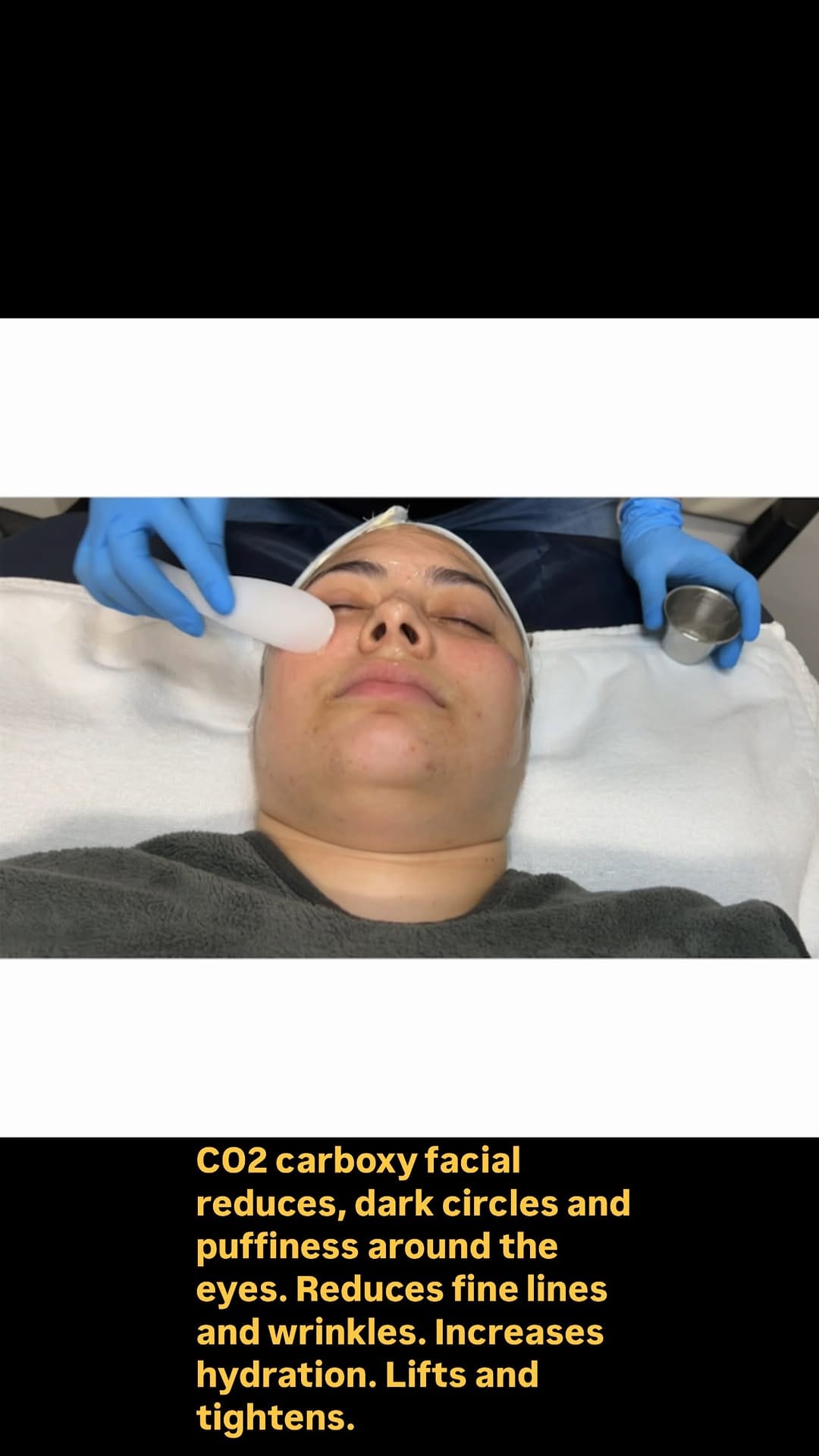 Post 7 by Flawless Skin Studio on Instagram (video)