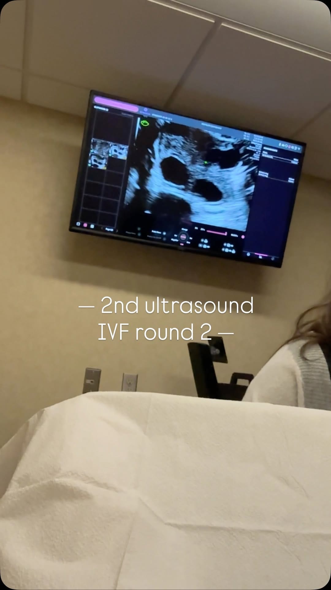 Post 2 by Kaylee Perkins | UGC on Instagram (video)