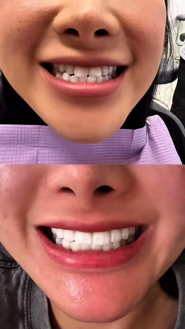Post 1 by Jenny Nguyen on Instagram (video)