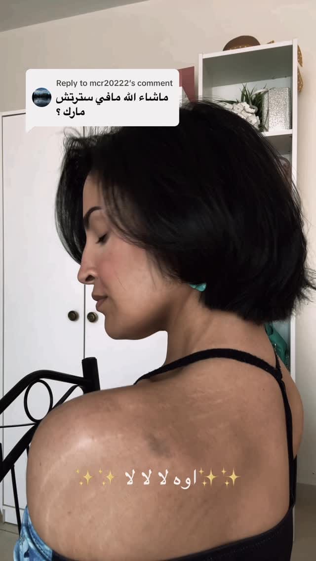 Post 9 by Dr.Yosra Alghamdi on Instagram (video)