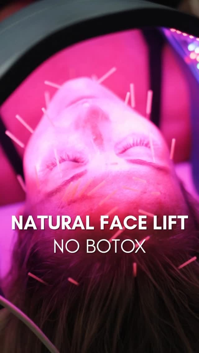 Post 5 by California Mobile Acupuncture on Instagram (video)