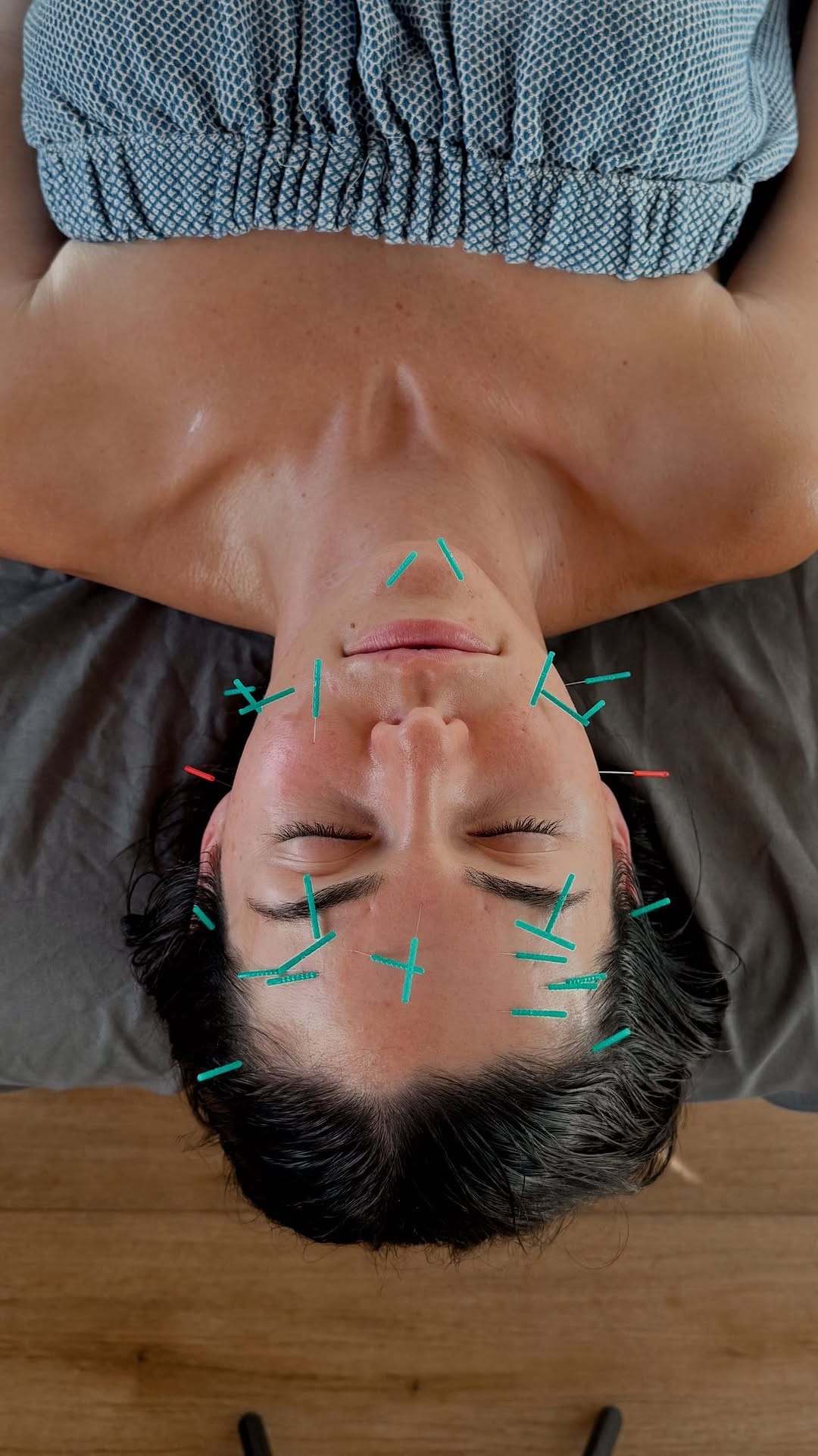 Post 3 by California Mobile Acupuncture on Instagram (video)