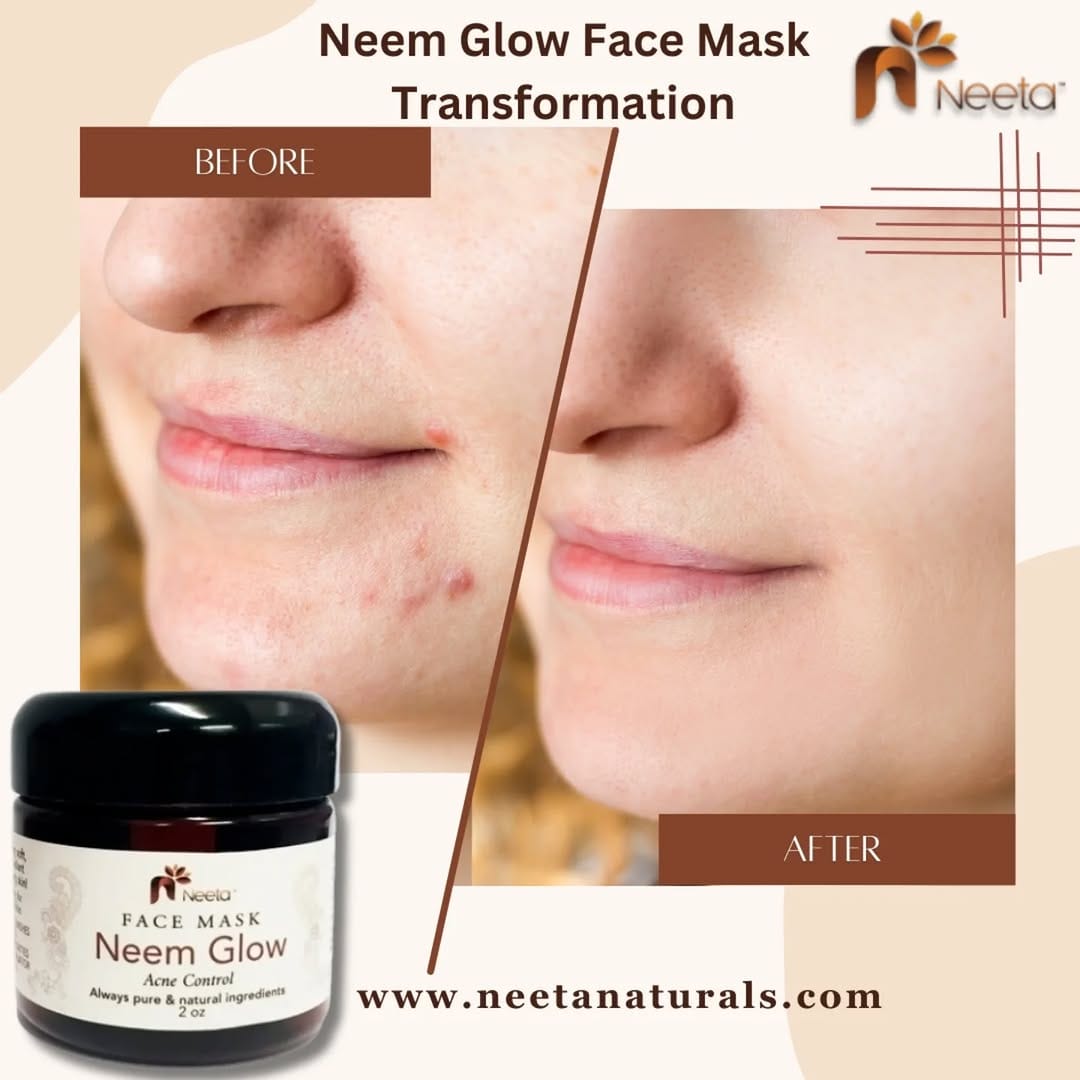 Post 9 by Neeta Naturals AYURVEDA on Instagram (image)