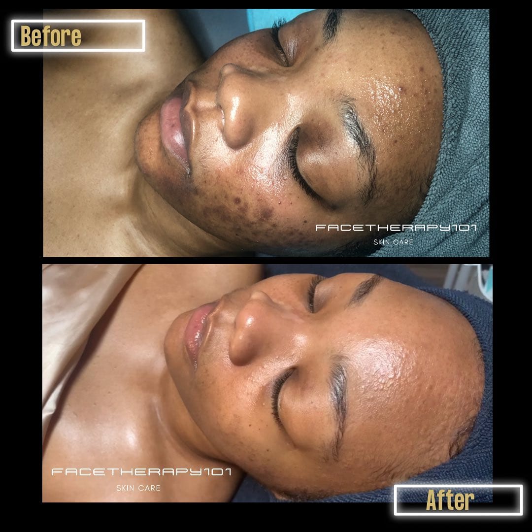 Post 10 by Bianca The Face Therapist on Instagram (carousel)
