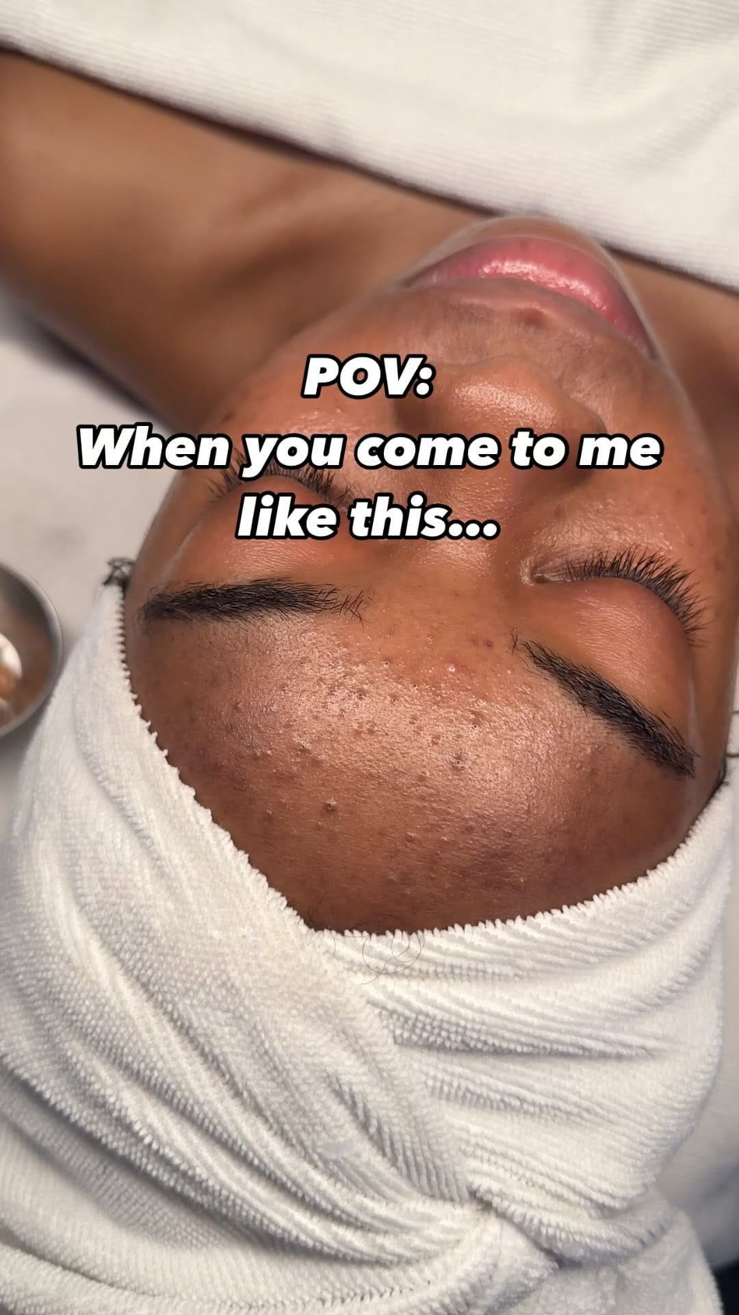 Post 9 by Bianca The Face Therapist on Instagram (video)