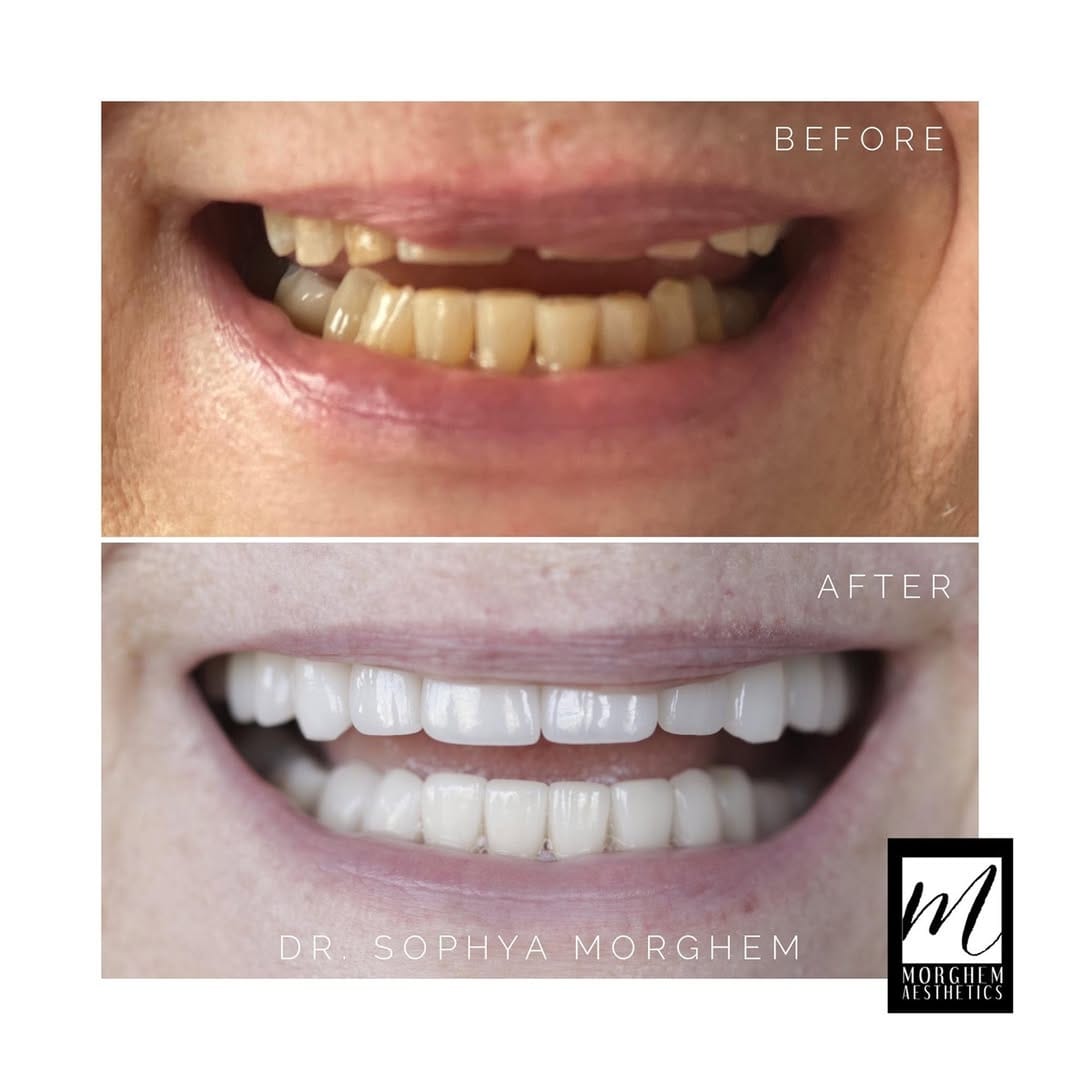 Post 10 by Cosmetic Dentist | Dr. Morghem on Instagram (image)