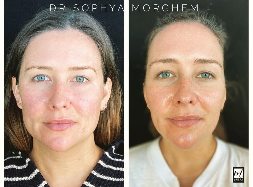 Post 5 by Cosmetic Dentist | Dr. Morghem on Instagram (image)