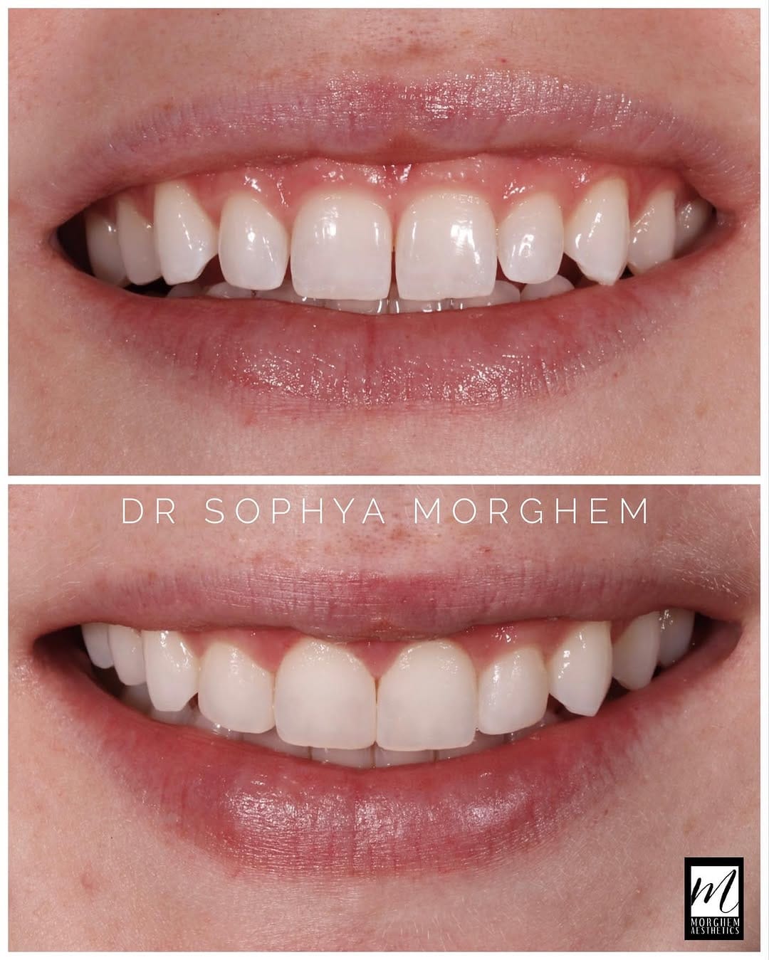 Post 3 by Cosmetic Dentist | Dr. Morghem on Instagram (image)
