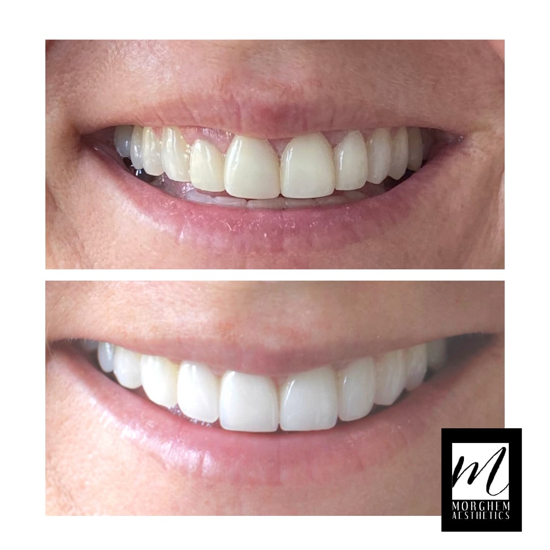 Post 9 by Cosmetic Dentist | Dr. Morghem on Instagram (image)