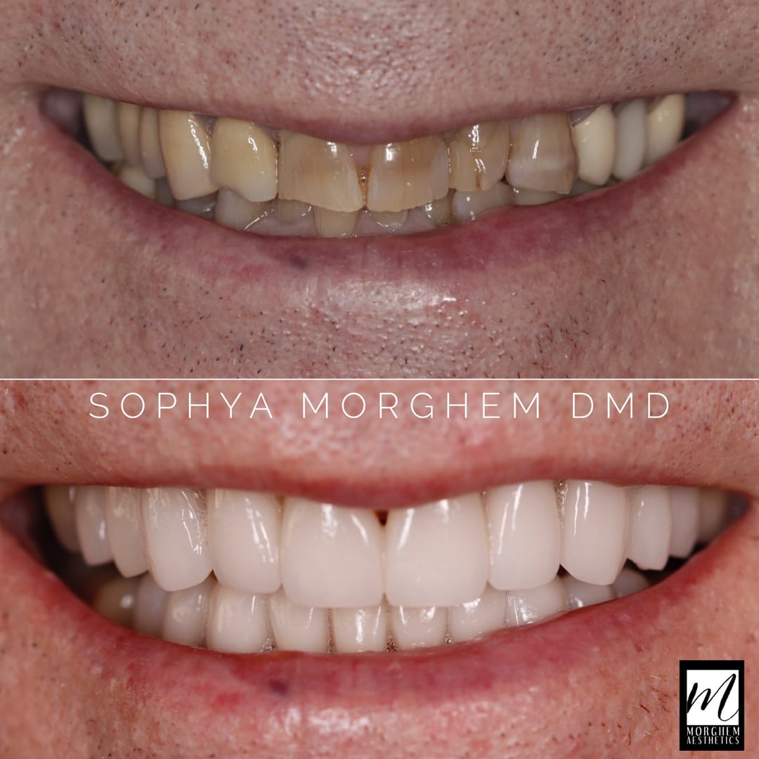 Post 8 by Cosmetic Dentist | Dr. Morghem on Instagram (image)