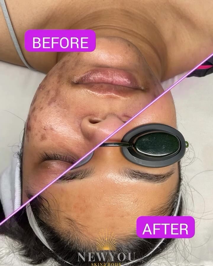 Post 5 by Jennifer Nguyen on Instagram (video)