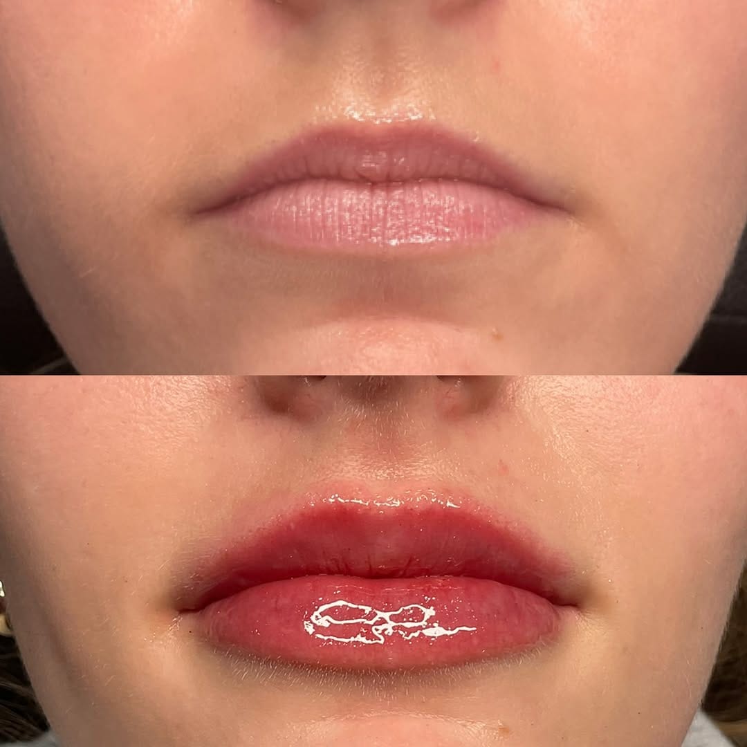 Post 5 by DALLAS INJECTOR ✮ Alisha Shuweb MSN, APRN, FNP-BC on Instagram (image)
