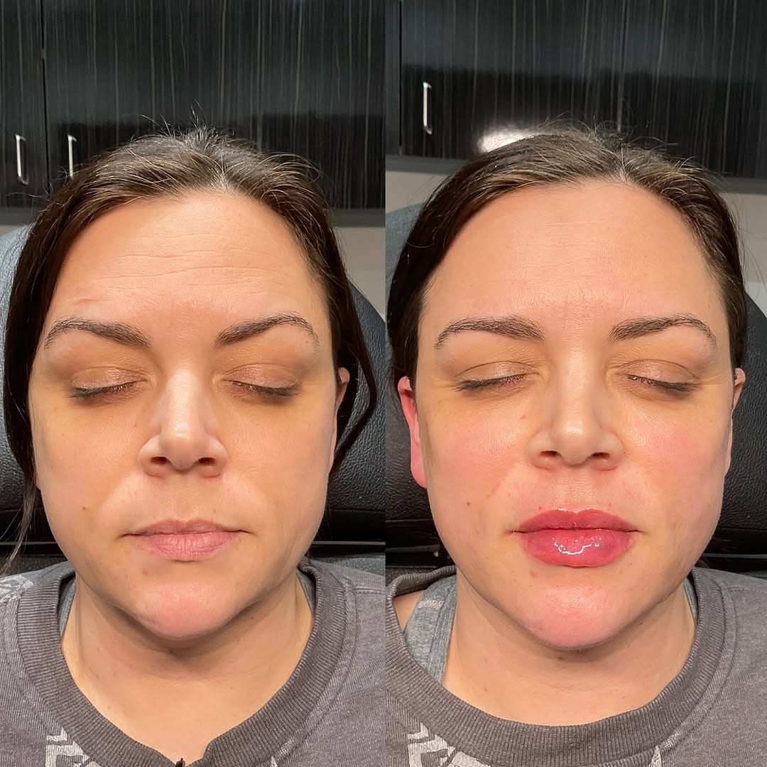 Post 3 by DALLAS INJECTOR ✮ Alisha Shuweb MSN, APRN, FNP-BC on Instagram (carousel)