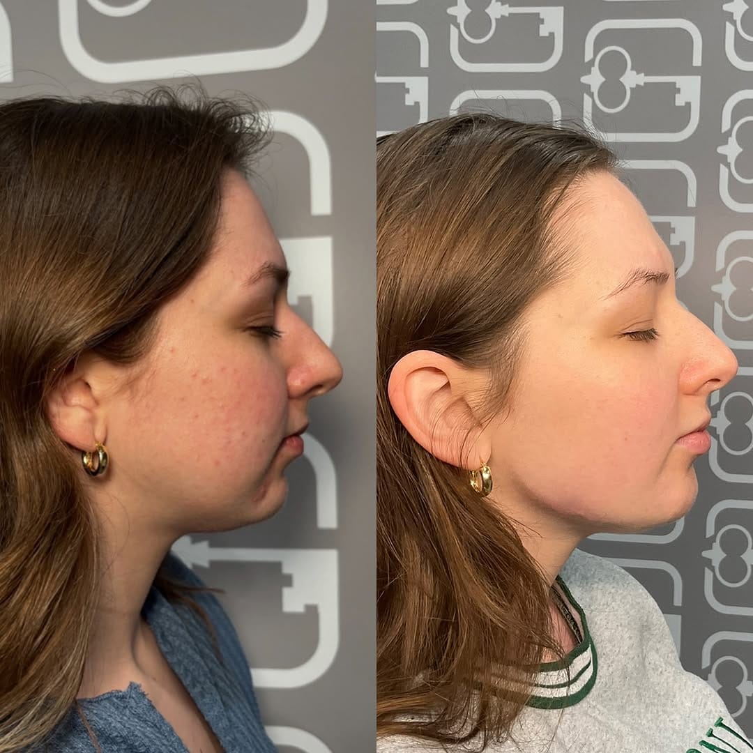 Post 7 by DALLAS INJECTOR ✮ Alisha Shuweb MSN, APRN, FNP-BC on Instagram (carousel)