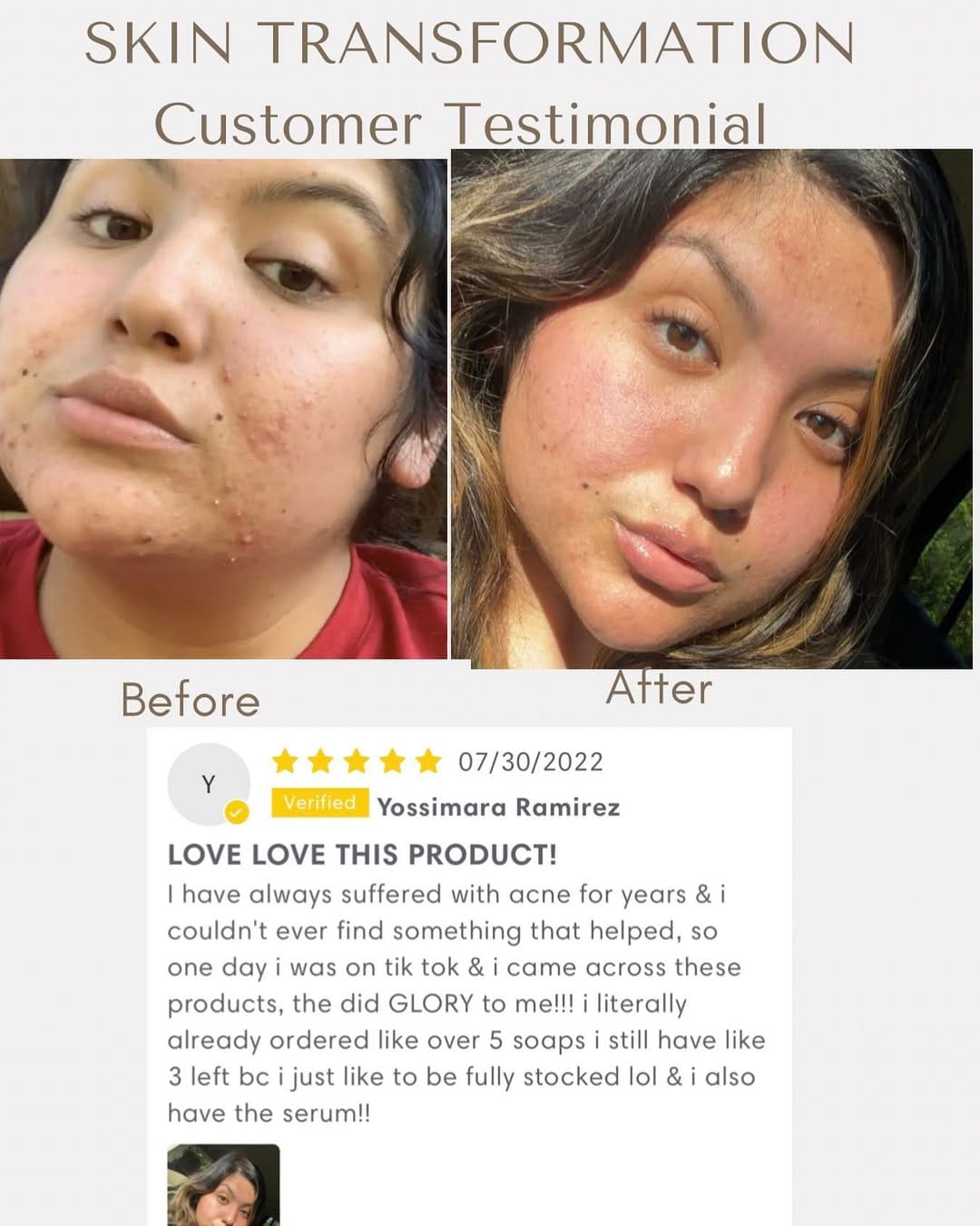 Post 10 by Clearglow Skincare on Instagram (image)