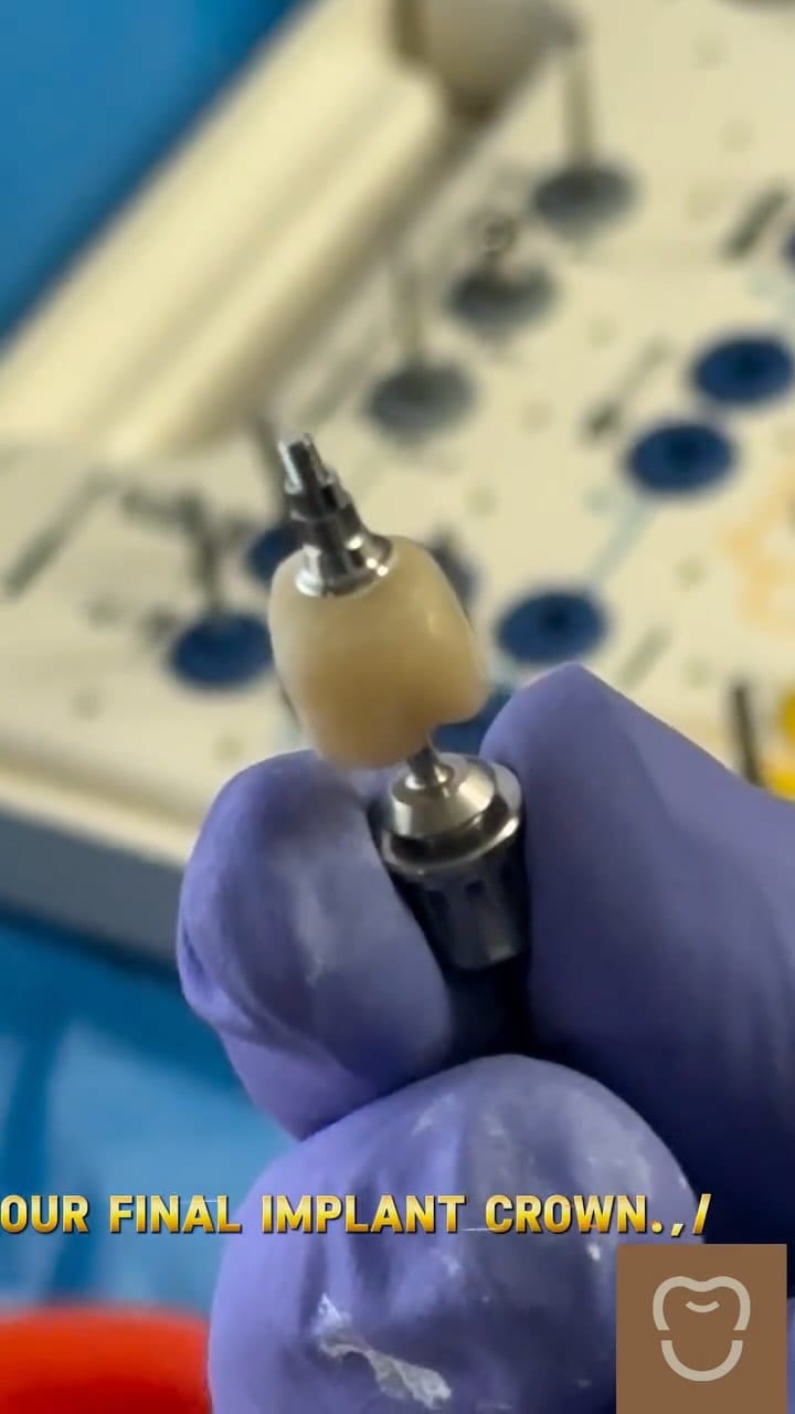 Post 4 by dr.sohrab.hashemi on Instagram (video)
