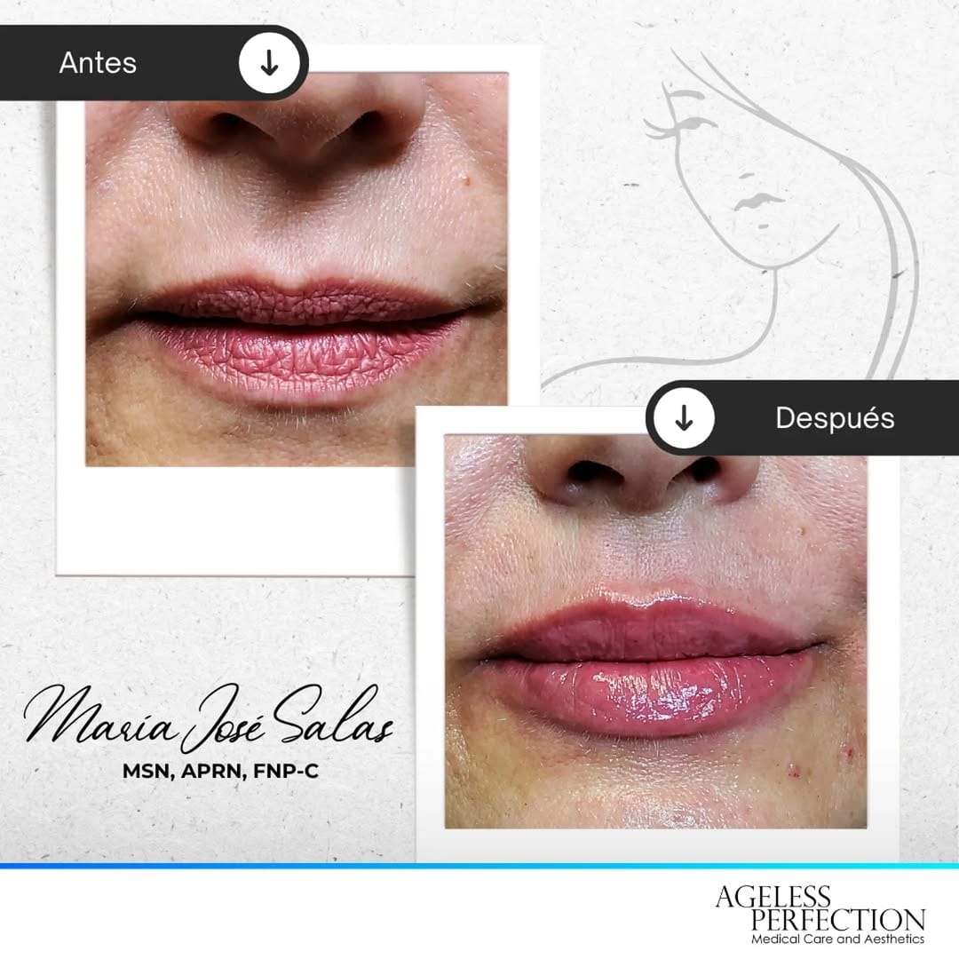 Post 4 by Maria Jose Salas MSN, APRN, FNP-C on Instagram (image)