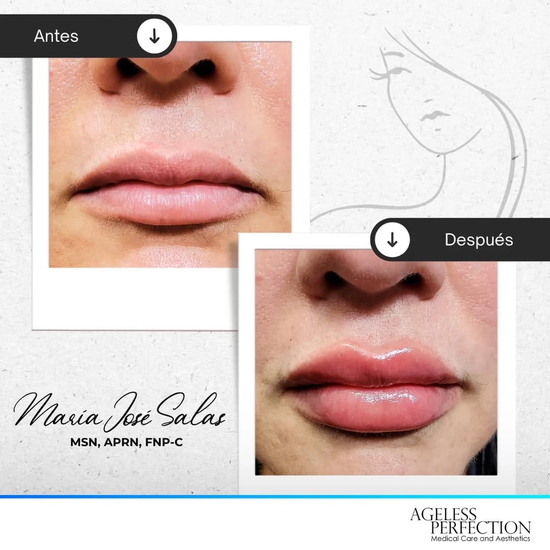 Post 8 by Maria Jose Salas MSN, APRN, FNP-C on Instagram (carousel)