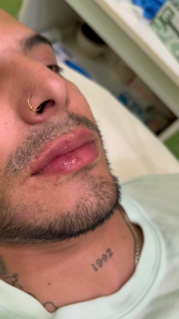 Post 10 by NYC🗽Botox | Fillers | PRP on Instagram (video)