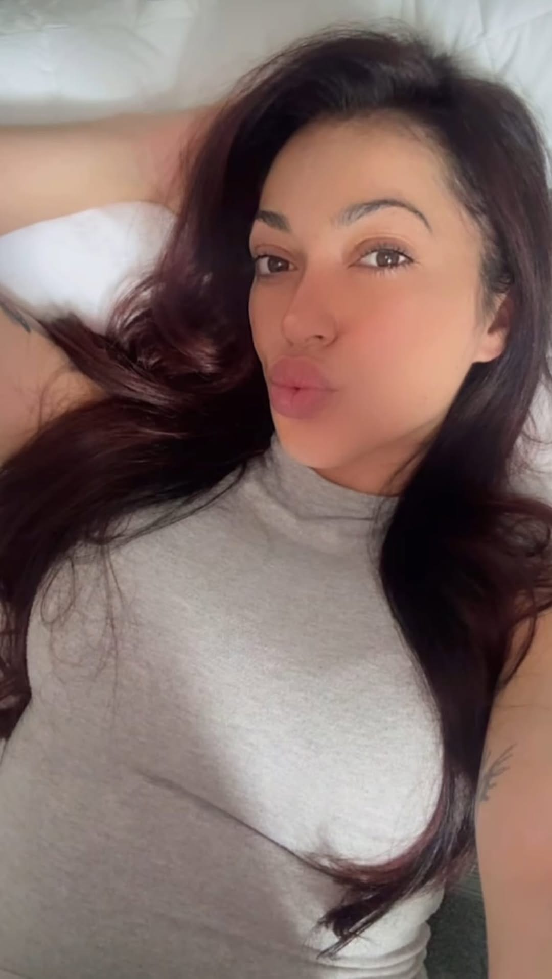 Post 7 by NYC🗽Botox | Fillers | PRP on Instagram (video)