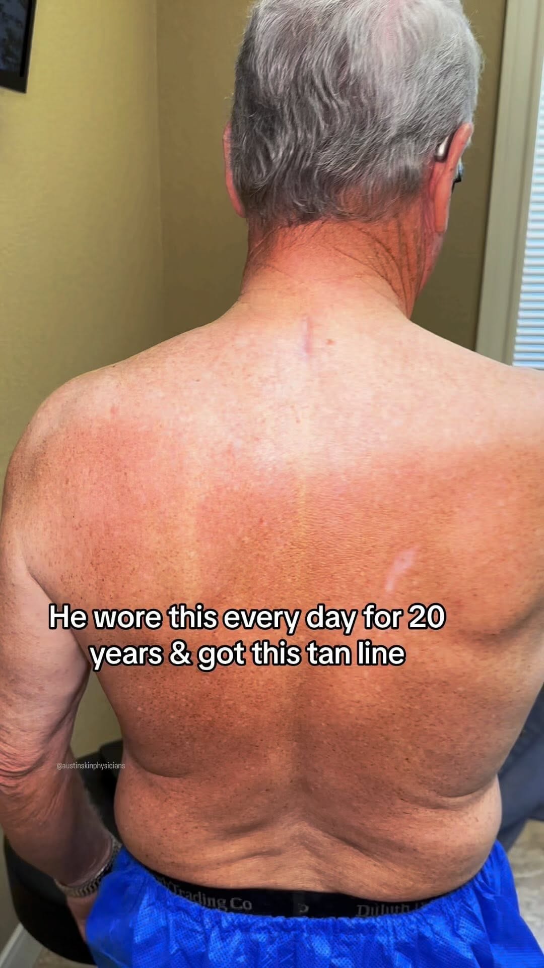 Post 10 by AUSTIN SKIN on Instagram (video)