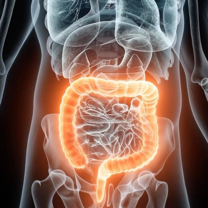 Post 10 by CleanColonic on Instagram (video)