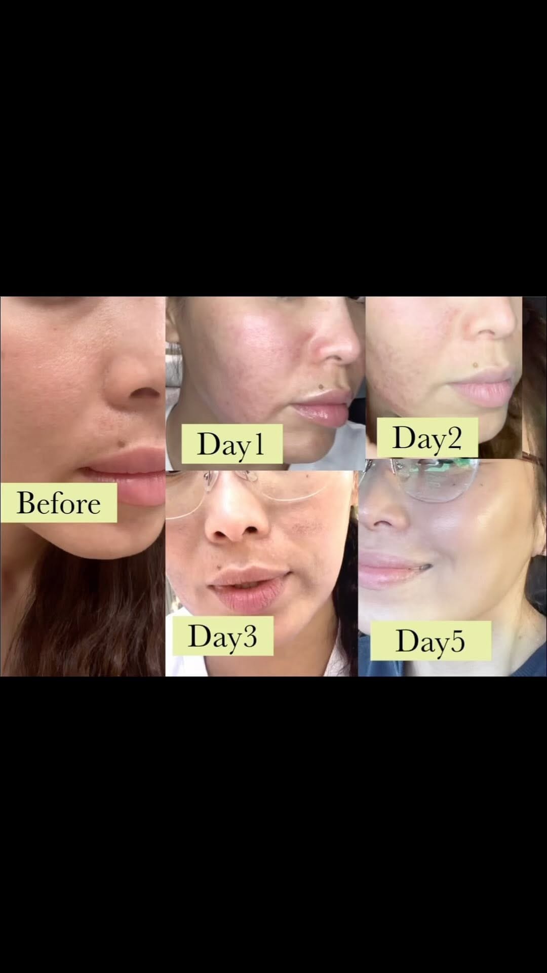 Post 3 by Dep Lashes on Instagram (video)