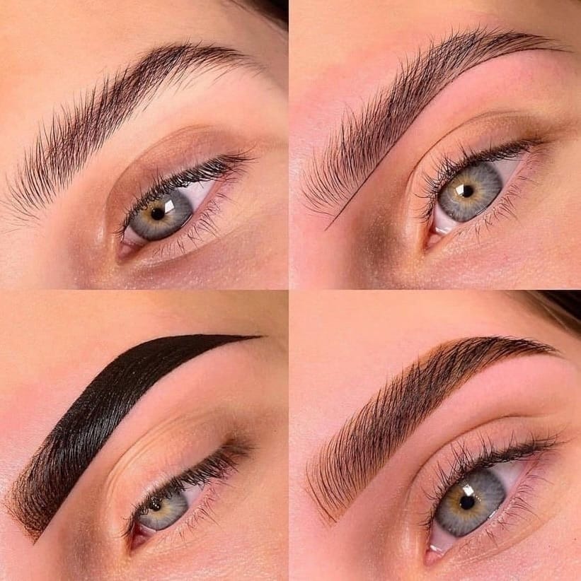 Post 7 by MediSkin Aesthetic Laser on Instagram (carousel)
