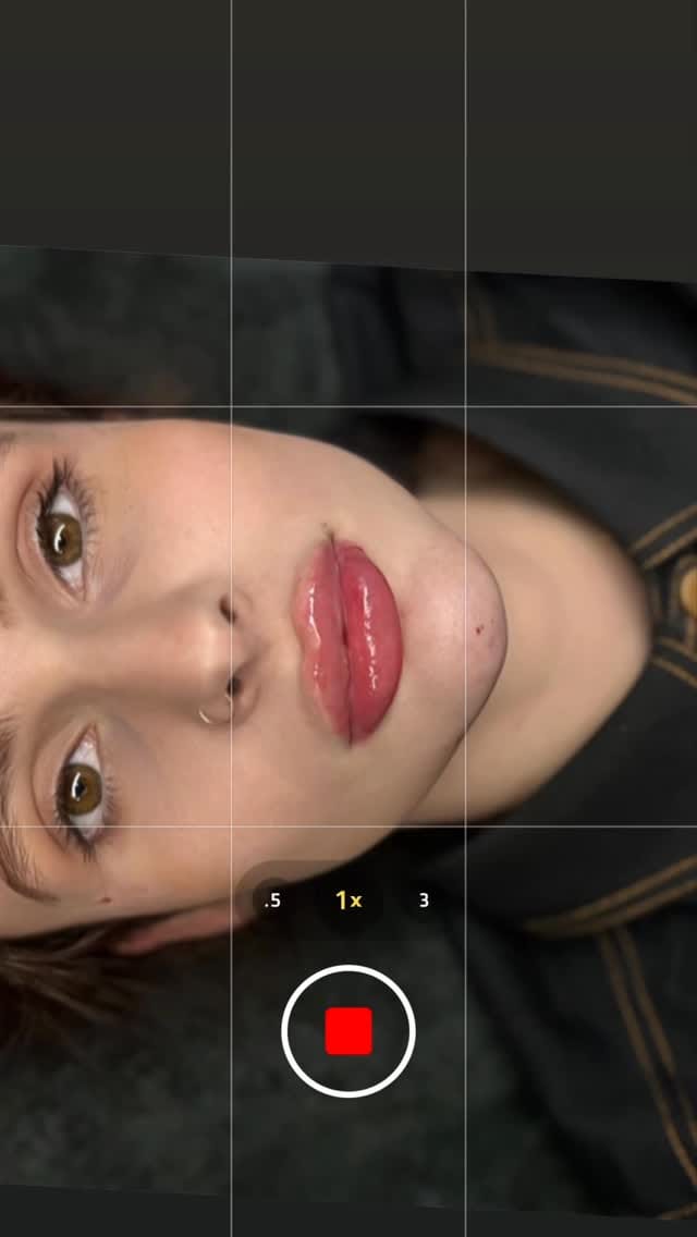 Post 1 by MediSkin Aesthetic Laser on Instagram (video)
