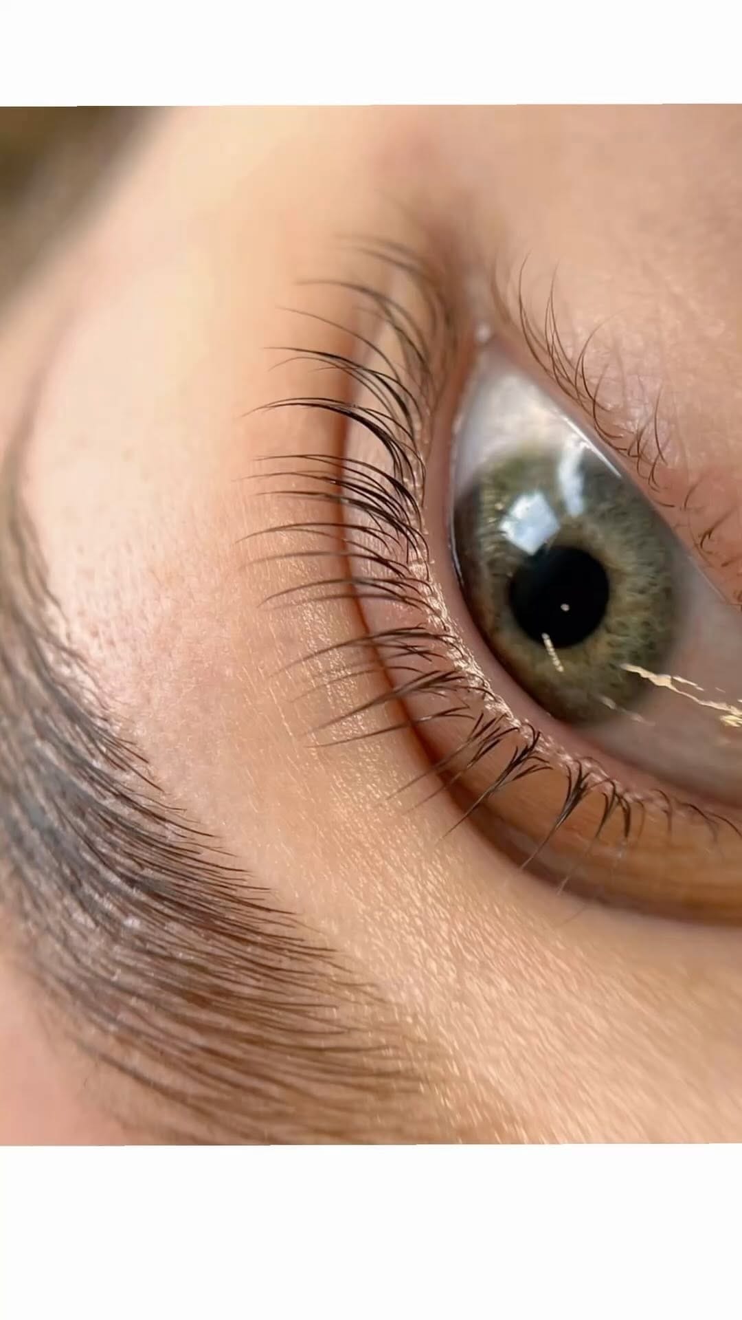 Post 6 by MediSkin Aesthetic Laser on Instagram (video)