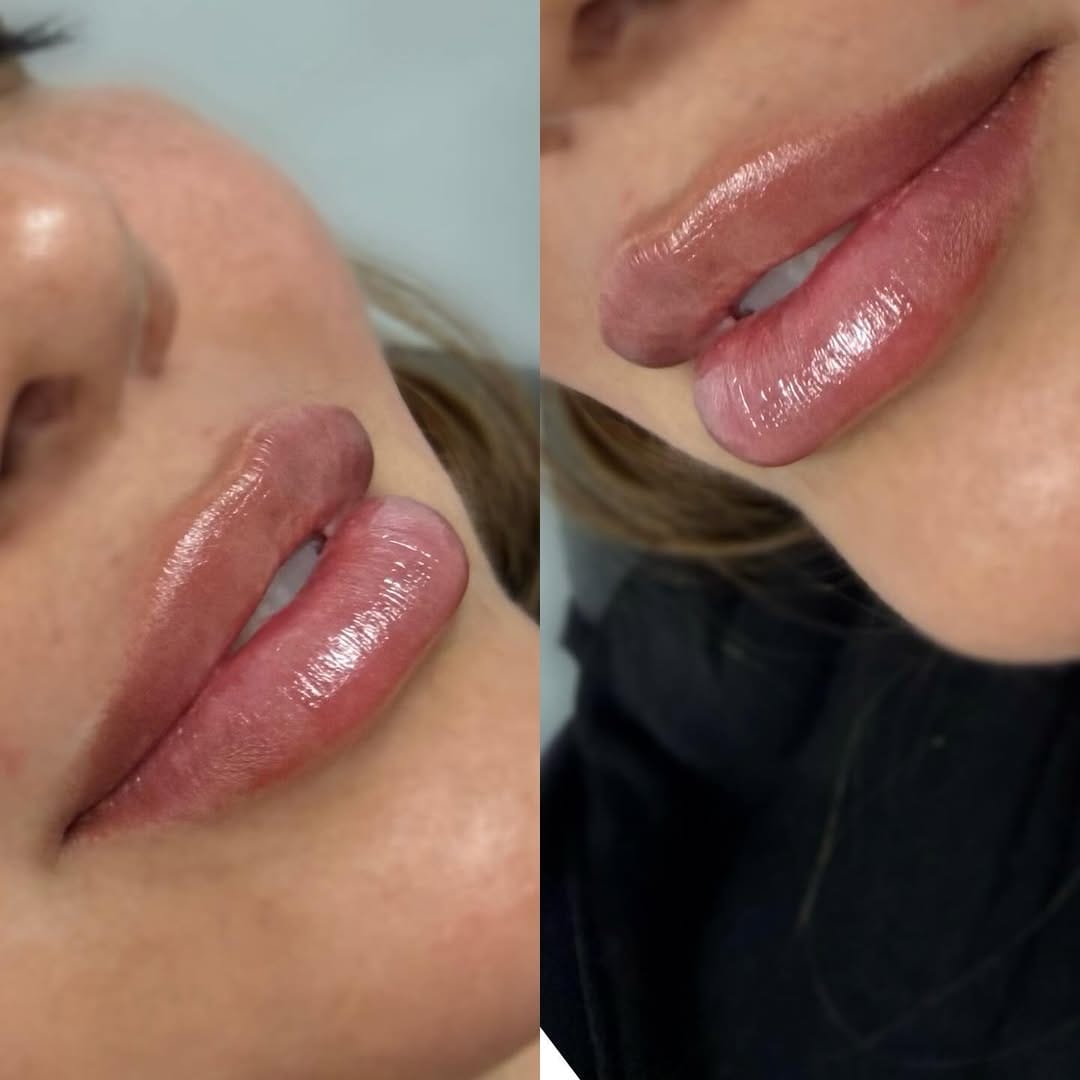 Post 6 by Higher Level Skin + Beauty on Instagram (carousel)