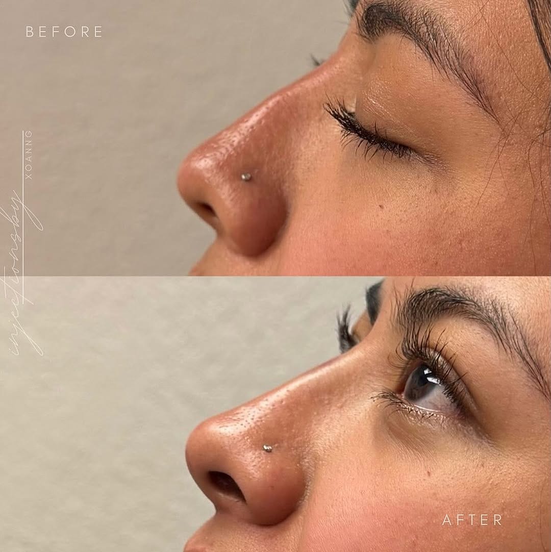 Post 7 by Higher Level Skin + Beauty on Instagram (carousel)