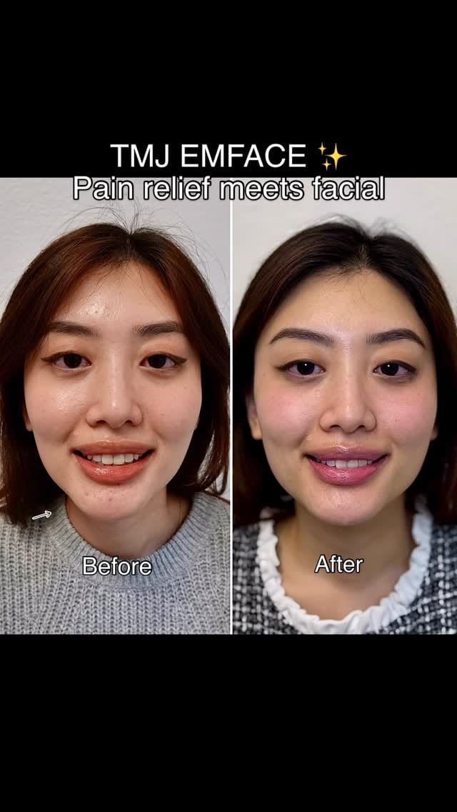 Post 3 by Nhu Dang, DDS, FICOI | Bella Dental Dallas on Instagram (video)