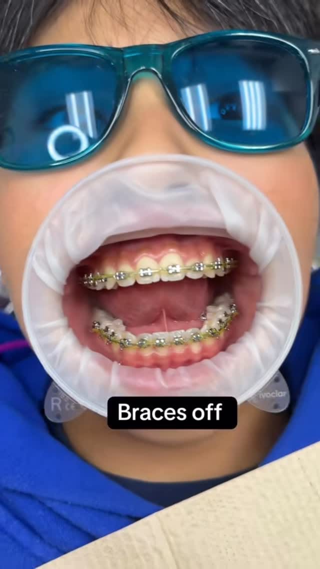 Post 6 by Nhu Dang, DDS, FICOI | Bella Dental Dallas on Instagram (video)