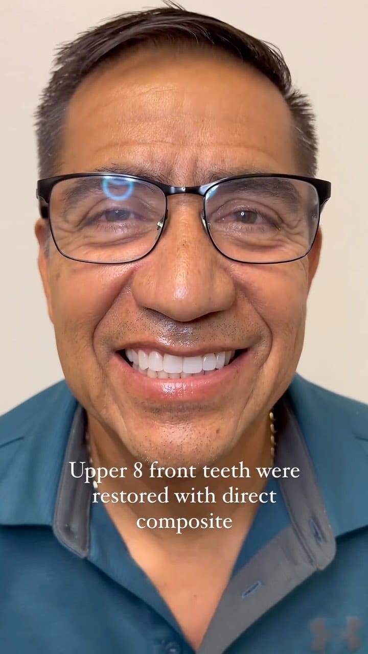 Post 10 by Nhu Dang, DDS, FICOI | Bella Dental Dallas on Instagram (video)