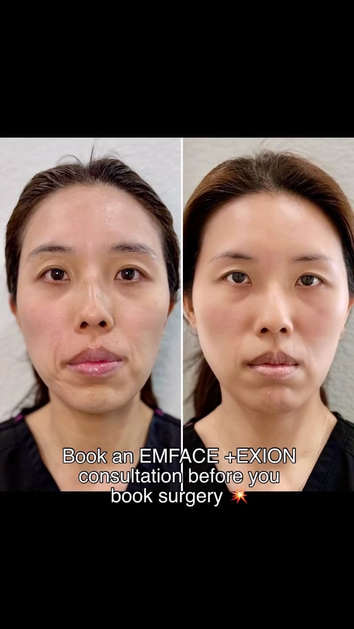 Post 7 by Nhu Dang, DDS, FICOI | Bella Dental Dallas on Instagram (video)