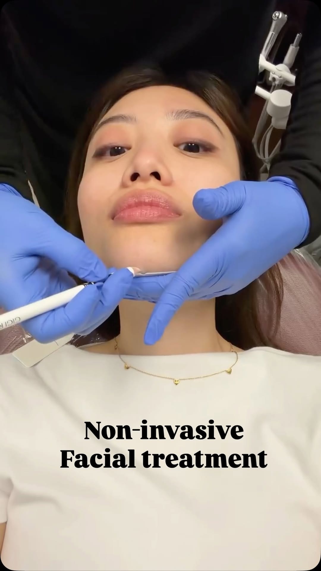 Post 2 by Nhu Dang, DDS, FICOI | Bella Dental Dallas on Instagram (video)
