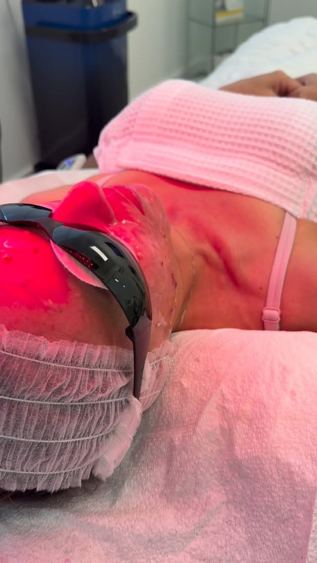 Post 6 by The Beauty Factory Clinic on Instagram (video)