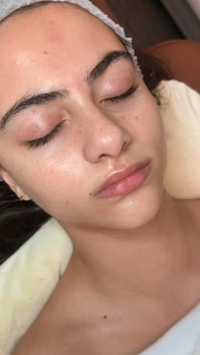 Post 1 by The Beauty Factory Clinic on Instagram (video)