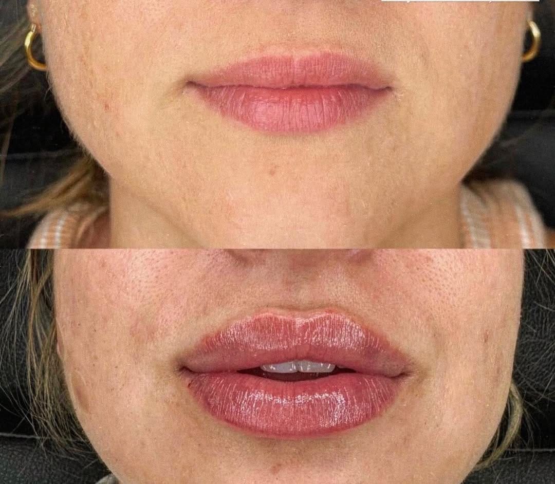 Post 8 by The Beauty Factory Clinic on Instagram (image)