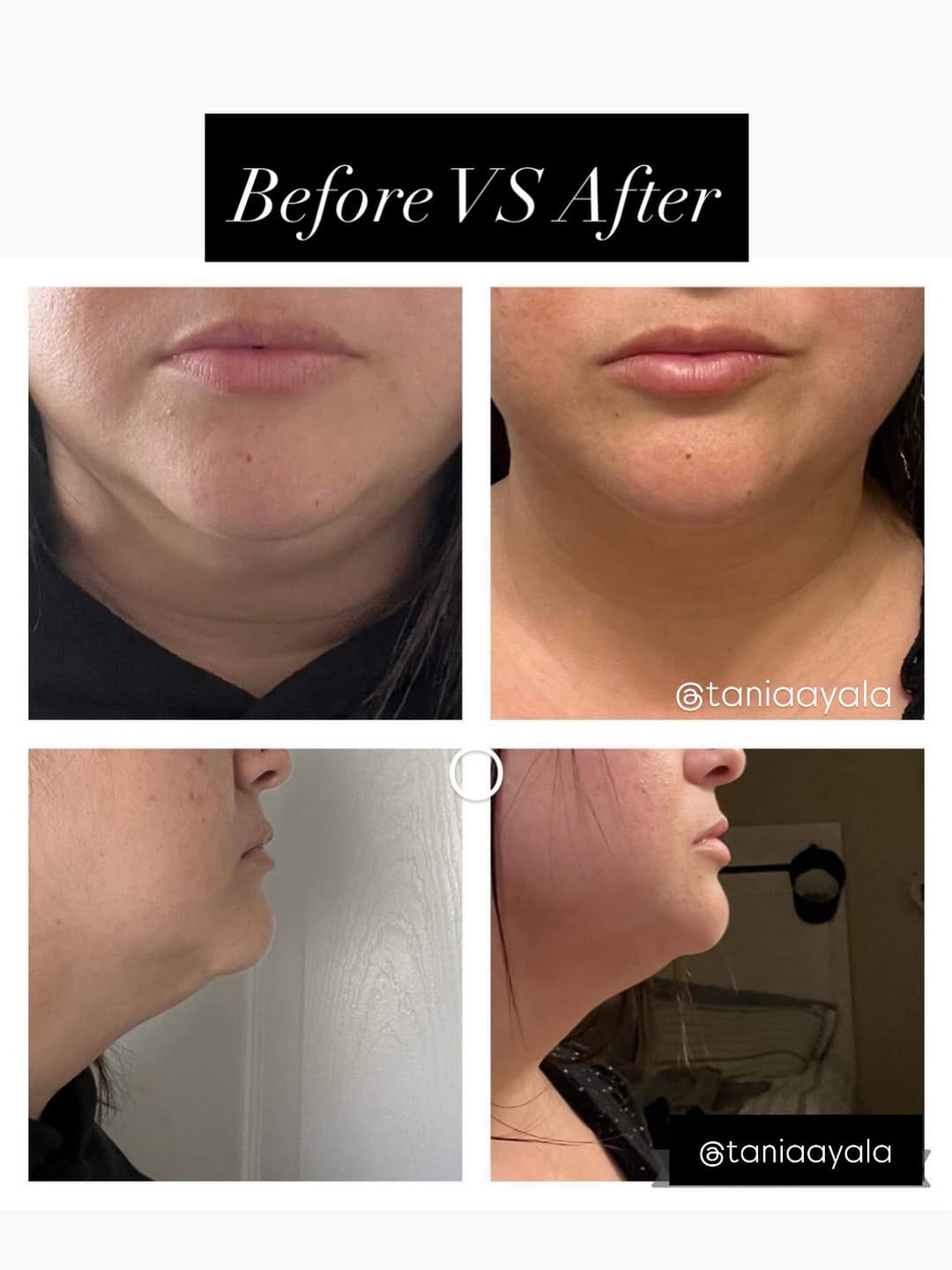 Post 3 by Tania Ayala | Body Sculpting SD on Instagram (image)