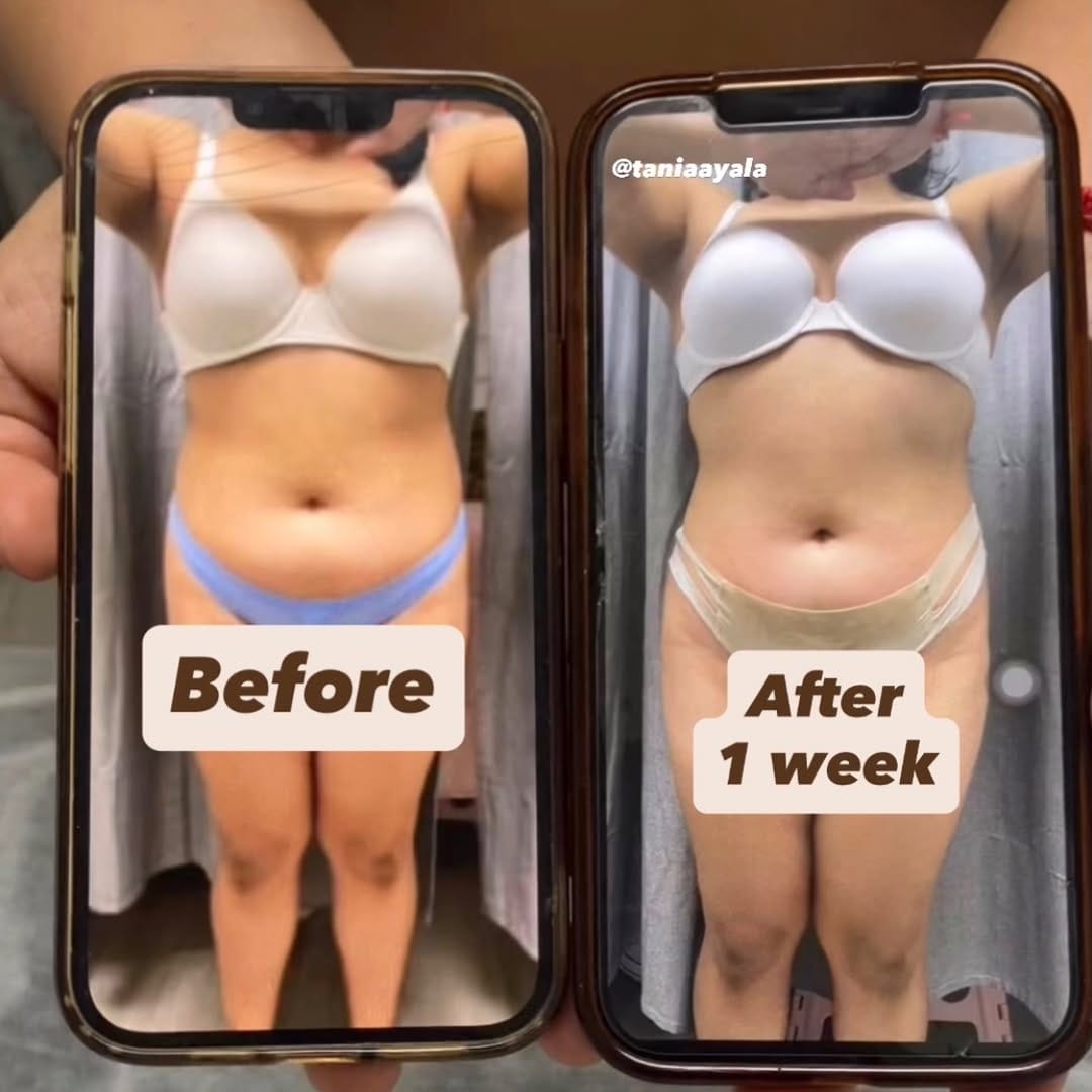 Post 1 by Tania Ayala | Body Sculpting SD on Instagram (image)