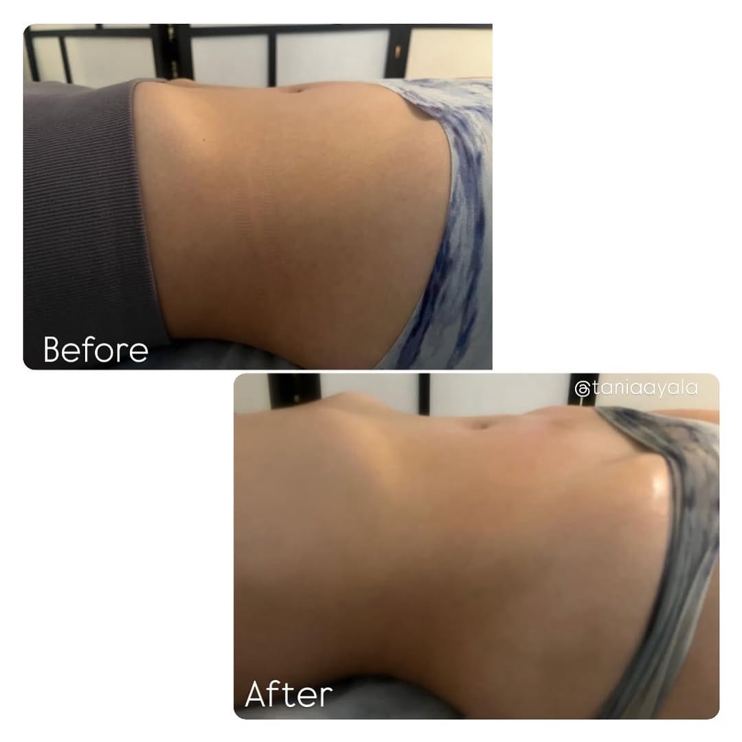Post 7 by Tania Ayala | Body Sculpting SD on Instagram (image)