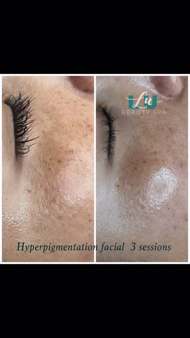 Post 6 by Chicago beauty spa on Instagram (video)