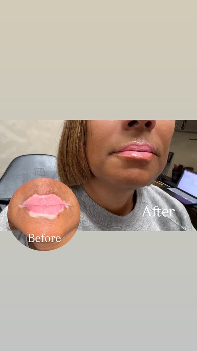 Post 2 by The Perfect Arch ® on Instagram (video)