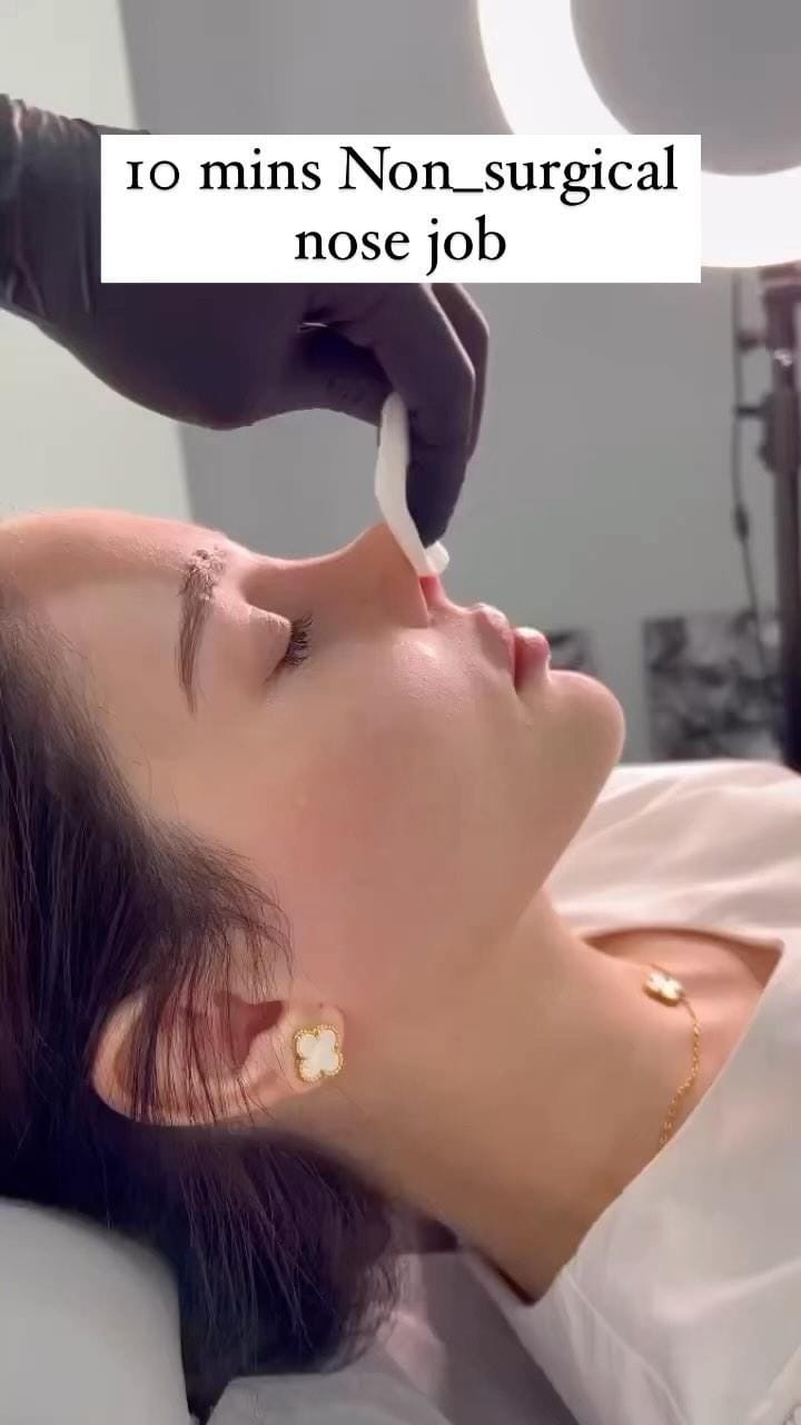 Post 10 by Botox + Filler + Nurse Injector | on Instagram (video)