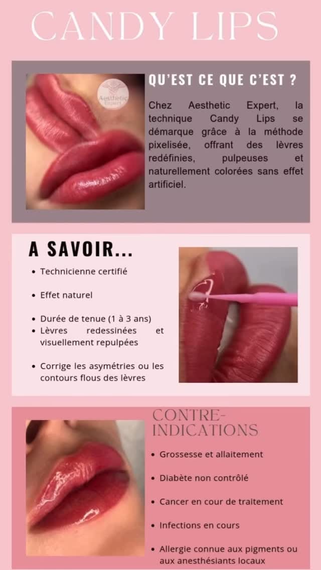 Post 6 by Aesthetic Expert | Centre esthetique et Formation Marseille on Instagram (video)